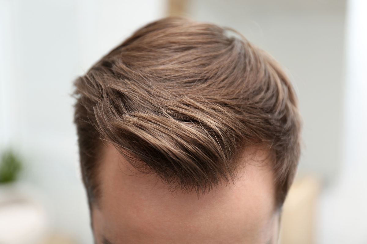 Come migliorare i capelli di un uomo: consigli e strategie efficaci