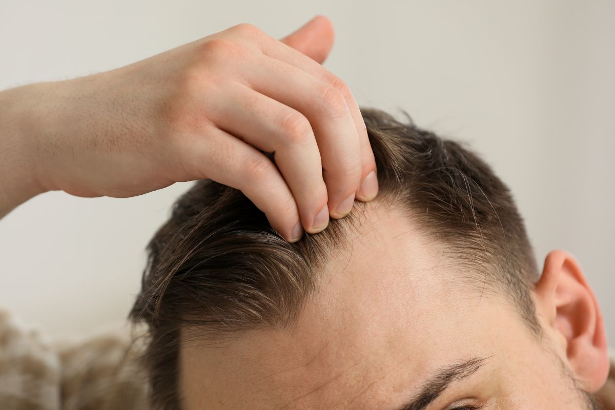 Come nascondere la stempiatura di un uomo