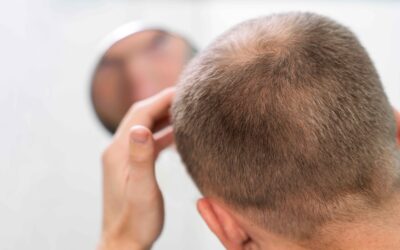Come scurire i capelli bianchi senza tinta? I metodi migliori da conoscere