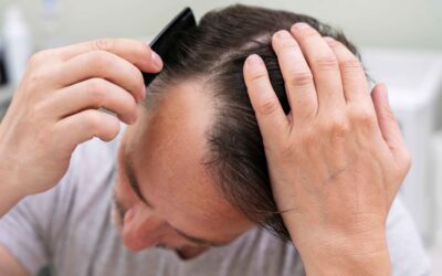 I metodi migliori per camuffare i capelli brizzolati