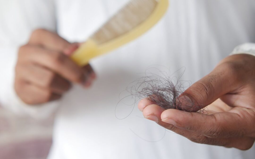Caduta capelli uomo: tutto quello che devi sapere e i rimedi