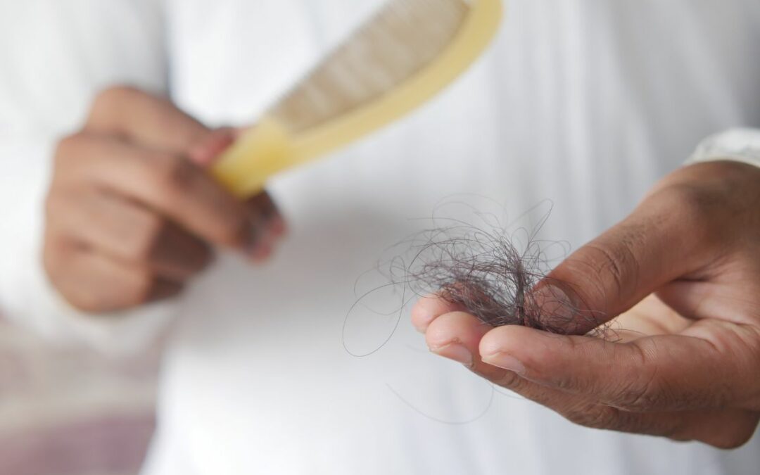 Caduta capelli uomo: tutto quello che devi sapere